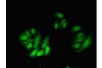 Immunofluorescent analysis of HepG2 cells using CSB-PA619782LA01HU at a dilution of 1:100 and Alexa Fluor 488-congugated AffiniPure Goat Anti-Rabbit IgG(H+L)