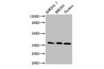 Western Blot<br />
Positive WB detected in:RAW264.7 whole cell lysate,HEK293 whole cell lysate,Mouse thymus tissue<br />
All lanes:FHL1 antibody at 3