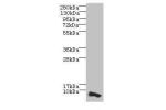 Western blot<br />
All lanes: COX17 antibody at 3.5ug/ml+HepG-2 whole cell lysate<br />
Goat polyclonal to rabbit at 1/10000 dilution<br />
Predicted band size: 7 kDa<br />
Observed band size: 7 kDa<br />