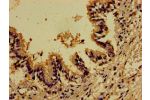 Immunohistochemistry of paraffin-embedded human lung tissue using CSB-PA619864LA01HU at dilution of 1:100