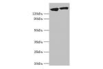Western blot<br />
All lanes:DCTN1 antibody at 20ug/ml<br />
Lane 1:mouse brain tissue<br />
Lane 2:Jurkat whole cell lysate<br />
Secondary<br />
Goat polyclonal to rabbit at 1/10000 dilution<br />
Predicted band size: 142,128,137,139,127,141 kDa<br />
O