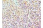 Immunohistochemistry of paraffin-embedded human tonsil using CSB-PA619867ESR2HUat dilution 1:100