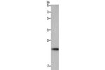 Gel: 10%SDS-PAGE, Lysate: 40 