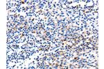 The image on the left is immunohistochemistry of paraffin-embedded Human tonsil tissue using CSB-PA620207(GADD45G Antibody) at dilution 1/120, on the right is treated with fusion protein. (Original magnification: 