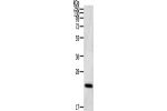 Gel: 12%SDS-PAGE, Lysate: 40 