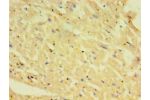 Immunohistochemistry of paraffin-embedded human heart tissue using CSB-PA620893LA01HU at dilution 1:100
