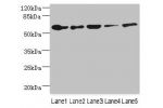 Western blot<br />
All lanes: CHRNA6 antibody at 2.29ug/ml<br />
Lane 1 : A431 whole cell lysate<br />
Lane 2 : Thp-1 whole cell lysate<br />
Lane 3 : A549 whole cell lysate<br />
Lane 4 : Hela whole cell lysate<br />
Lane 5 : HepG-2 whole cell lysate<br 