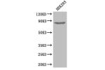 Western Blot<br />
Positive WB detected in:HEK293 whole cell lysate<br />
All lanes: EXT1 antibody at 3.3ug/ml<br />
Secondary<br />
Goat polyclonal to rabbit IgG at 1/50000 dilution<br />
Predicted band size: 87 kDa<br />
Observed band size: 87 kDa<br />