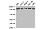 Western Blot<br />
Positive WB detected in:Hela whole cell lysate,Jurkat whole cell lysate,HEK293 whole cell lysate,NIH/3T3 whole cell lysate,A549 whole cell lysate<br />
All lanes:DDR2 antibody at 3.5