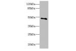 Western blot<br />
All lanes: COX10 antibody at 5.31ug/ml+ Mouse gonadal tissue<br />
Goat polyclonal to rabbit at 1/10000 dilution<br />
Predicted band size: 49,28 kDa<br />
Observed band size: 49 kDa<br />