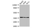 Western Blot<br />
Positive WB detected in:HepG2 whole cell lysate,A549 whole cell lysate,Hela whole cell lysate<br />
All lanes:ECH1 antibody at 2.5