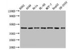 Western Blot<br />
Positive WB detected in:K562 whole cell lysate,A549 whole cell lysate,Hela whole cell lysate,HL-60 whole cell lyasate,MCF-7 whole cell lysate,HepG2 whole cell lysate,SH-SY5Y whole cell lysate<br />
All lanes:TARDBP antibody at 2.5