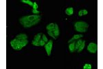 Immunofluorescent analysis of HepG2 cells using CSB-PA621785LA01HU at a dilution of 1:100 and Alexa Fluor 488-congugated AffiniPure Goat Anti-Rabbit IgG(H+L)