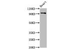 Western Blot<br />
Positive WB detected in:Rat heart tissue<br />
All lanes:DLG2 antibody at 2.8