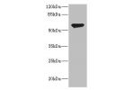 Western blot<br />
All lanes: CHRNA2antibody IgG at 2.41ug/ml+ HL60 whole cell lysate<br />
Secondary<br />
Goat polyclonal to rabbit IgG at 1/10000 dilution<br />
Predicted band size: 60,59 kDa<br />
Observed band size: 60 kDa<br />