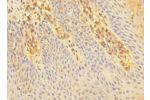 Immunohistochemistry of paraffin-embedded human tonsil tissue CSB-PA621886ESR2HU at dilution 1:100