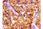 IHC image of CSB-PA621965LA01HU diluted at 1:100 and staining in paraffin-embedded human adrenal gland tissue performed on a Leica BondTM system. After dewaxing and hydration, antigen retrieval was mediated by high pressure in a citrate buffer (pH 6.0). S