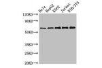 Western Blot<br />
Positive WB detected in:Hela whole cell lysate,HepG2 whole cell lysate,K562 whole cell lysate,Jurkat whole cell lysate,NIH/3T3 whole cell lysate<br />
All lanes:CPSF6 antibody at 3