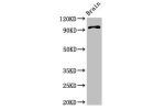 Western Blot<br />
Positive WB detected in:Mouse brain tissue<br />
All lanes:ABR antibody at 3.4