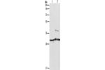 Gel: 10%SDS-PAGE, Lysate: 40 