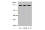 Western blot<br />
All lanes: ACAP1 antibody at 4ug/ml<br />
Lane 1 : Mouse lung tissue<br />
Lane 2 : Jurkat whole cell lysate<br />
Lane 3 : K562 whole cell lysate<br />
Secondary<br />
Goat polyclonal to Rabbit IgG at 1/10000 dilution<br />
Predicted b