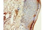 Immunohistochemistry of paraffin-embedded human skin using CSB-PA623015ESR2HU at dilution 1:100