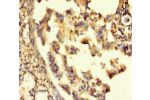 Immunohistochemistry of paraffin-embedded human lung tissue using CSB-PA623078LA01HU at dilution of 1:100