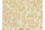 Immunohistochemistry of paraffin-embedded human liver tissue CSB-PA623168LA01HU at dilution 1:100