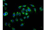 Immunofluorescence staining of A549 cells with CSB-PA623657LA01HU at 1:66,counter-stained with DAPI. The cells were fixed in 4% formaldehyde, permeabilized using 0.2% Triton X-100 and blocked in 10% normal Goat Serum. The cells were then incubated with th