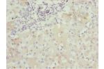 Immunohistochemistry of paraffin-embedded human liver tissue using CSB-PA623663ESR1HU at dilution 1:100