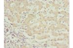 Immunohistochemistry of paraffin-embedded human liver tissue using CSB-PA623663ESR2HU at dilution 1:100
