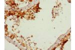 Immunohistochemistry of paraffin-embedded human testis tissue using CSB-PA623785ESR1HU at dilution 1:100