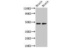 Western Blot<br />
Positive WB detected in:Rat brain tissue,Mouse brain tissue<br />
All lanes:CRHR2 antibody at 3