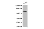 Western Blot<br />
Positive WB detected in:Mouse lung tissue<br />
All lanes: BIRC3 antibody at 4ug/ml<br />
Secondary<br />
Goat polyclonal to rabbit IgG at 1/50000 dilution<br />
Predicted band size: 69 kDa<br />
Observed band size: 69 kDa<br />