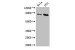 Western Blot<br />
Positive WB detected in:Hela whole cell lysate,PC3 whole cell lysate<br />
All lanes:CUL2 antibody at 5ug/ml<br />
Secondary<br />
Goat polyclonal to rabbit IgG at 1/50000 dilution<br />
Predicted band size: 87,90 kDa<br />
Observed ban