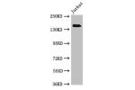 Western Blot<br />
Positive WB detected in:Jurkat whole cell lysate<br />
All lanes:EIF3A antibody at 4