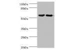 Western blot<br />
All lanes:Dihydropyrimidinase-related protein 1 antibody at 2ug/ml<br />
Lane 1:rat brain tissue<br />
Lane 2:mouse lung tissue<br />
Secondary<br />
Goat polyclonal to rabbit at 1/10000 dilution<br />
Predicted band size: 63,75 kDa<br 