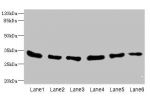 Western blot<br />
All lanes: EIF2B1 antibody at 5.14ug/ml<br />
Lane 1 : MCF7 whole cell lysate<br />
Lane 2 : K562 whole cell lysate<br />
Lane 3 : Mouse liver tissue<br />
Lane 4 : Mouse brain tissue<br />
Lane 5 : Jurkat whole cell lysate<br />
Lane 6