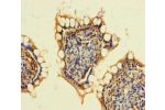 Immunohistochemistry of paraffin-embedded human small intestine tissue using CSB-PA623954LA01HU at dilution of 1:100