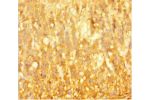 Immunohistochemistry of paraffin-embedded human adrenal gland tissue using CSB-PA624013HA01HU at dilution 1:100