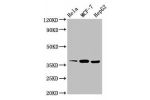 Western Blot<br />
Positive WB detected in:Hela whole cell lysate,MCF-7 whole cell lysate,HepG2 whole cell lysate<br />
All lanes:ALX1 antibody at 3