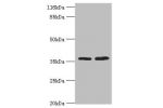 Western blot<br />
All lanes:ACKR1 antibody at 2ug/ml<br />
Lane 1:mouse kidney tissue<br />
Lane 2mouse spleen tissue<br />
Secondary<br />
Goat polyclonal to rabbit at 1/10000 dilution<br />
Predicted band size: 36kDa<br />
Observed band size: 36kDa<br 