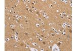 The image on the left is immunohistochemistry of paraffin-embedded Human brain tissue using CSB-PA627130(GNB5 Antibody) at dilution 1/20, on the right is treated with fusion protein. (Original magnification: 