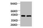 Western blot analysis of 1) Rat Brain Tissue, 2)Mouse Brain Tissue with GALR2 Rabbit pAb diluted at 1:2,000.