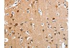 The image on the left is immunohistochemistry of paraffin-embedded Human brain tissue using CSB-PA632657(ANKRD54 Antibody) at dilution 1/50, on the right is treated with fusion protein. (Original magnification: 