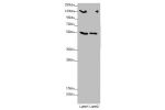 Western blot<br />
All lanes:CSPP1 antibody at 1.53 ug/ml<br />
Lane 1 : 293T whole cell lysate<br />
Lane 2 : Jurkat whole cell lysate<br />
Secondary<br />
Goat polyclonal to rabbit IgG at 1/10000 dilution<br />
Predicted band size: 146,142,102 kDa<br /