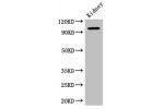Western Blot<br />
Positive WB detected in:Mouse kidney tissue<br />
All lanes: AAK1 antibody at 2.5ug/ml<br />
Secondary<br />
Goat polyclonal to rabbit IgG at 1/50000 dilution<br />
Predicted band size: 104,94 kDa<br />
Observed band size: 104 kDa<br />