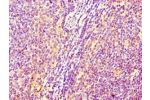 Immunohistochemistry of paraffin-embedded human lymph node tissue using CSB-PA643573LA01HU at dilution of 1:100