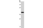 Gel: 8%SDS-PAGE, Lysate: 40 