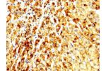 IHC image of CSB-PA647192LA01HU diluted at 1:250 and staining in paraffin-embedded human adrenal gland tissue performed on a Leica BondTM system. After dewaxing and hydration, antigen retrieval was mediated by high pressure in a citrate buffer (pH 6.0). S